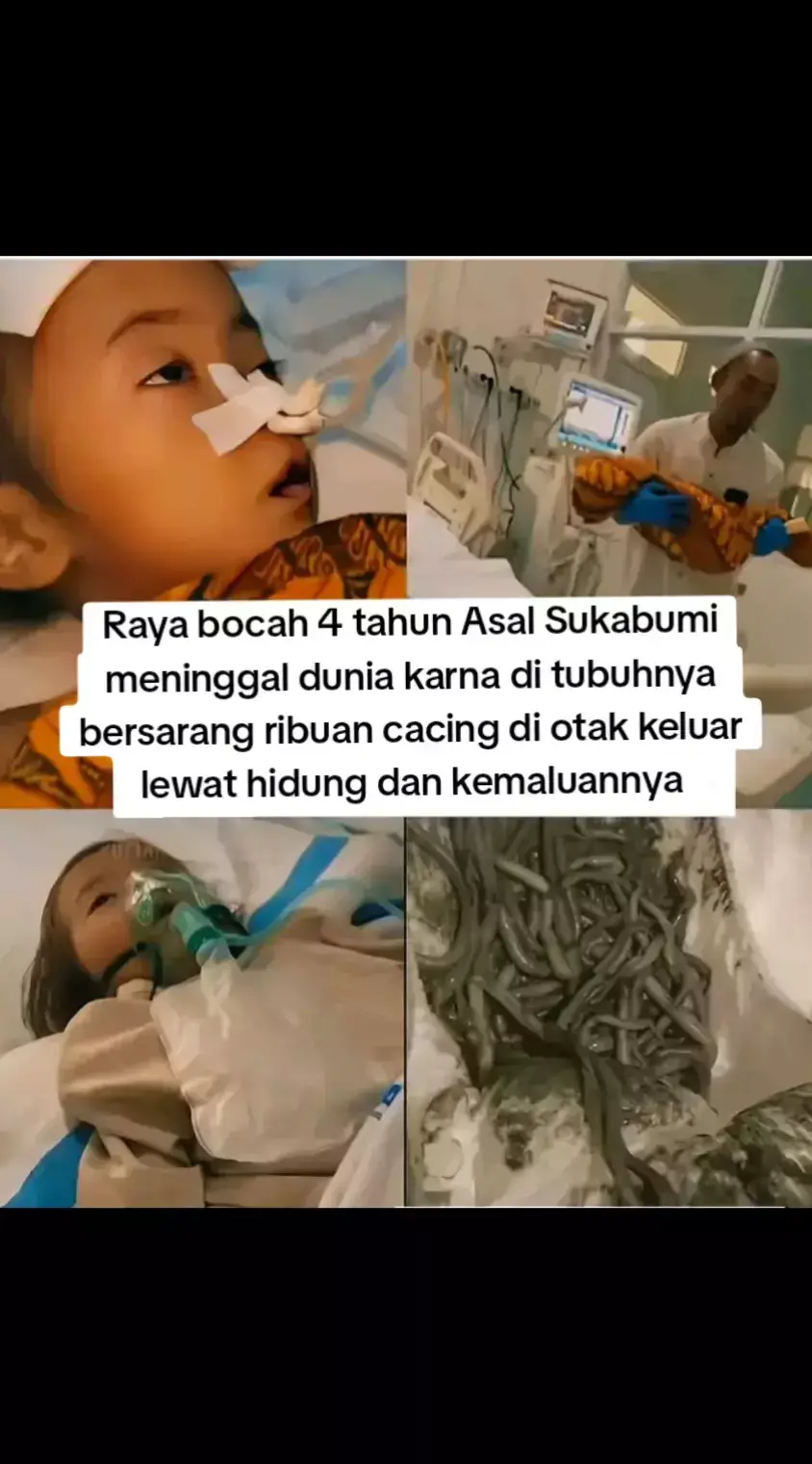 Merinding tau berita ini ,ribuan cacing bersarang di tubuhnya satu aja udah ngerasa risih ini sampe ribuan cacing ,takut bngt jadinya anakku seneng banget main pasir makannya kalau Mau tidur harus cuci tangan cuci kaki ganti baju dlu ,ibu* yang baca caption ini pasti ngerasa was-was ,jangan lupa jaga kebersihan biar terhindar dari hal hal seperti ini 🥲 #ripraya #bocahsukabumi #beritaviral 