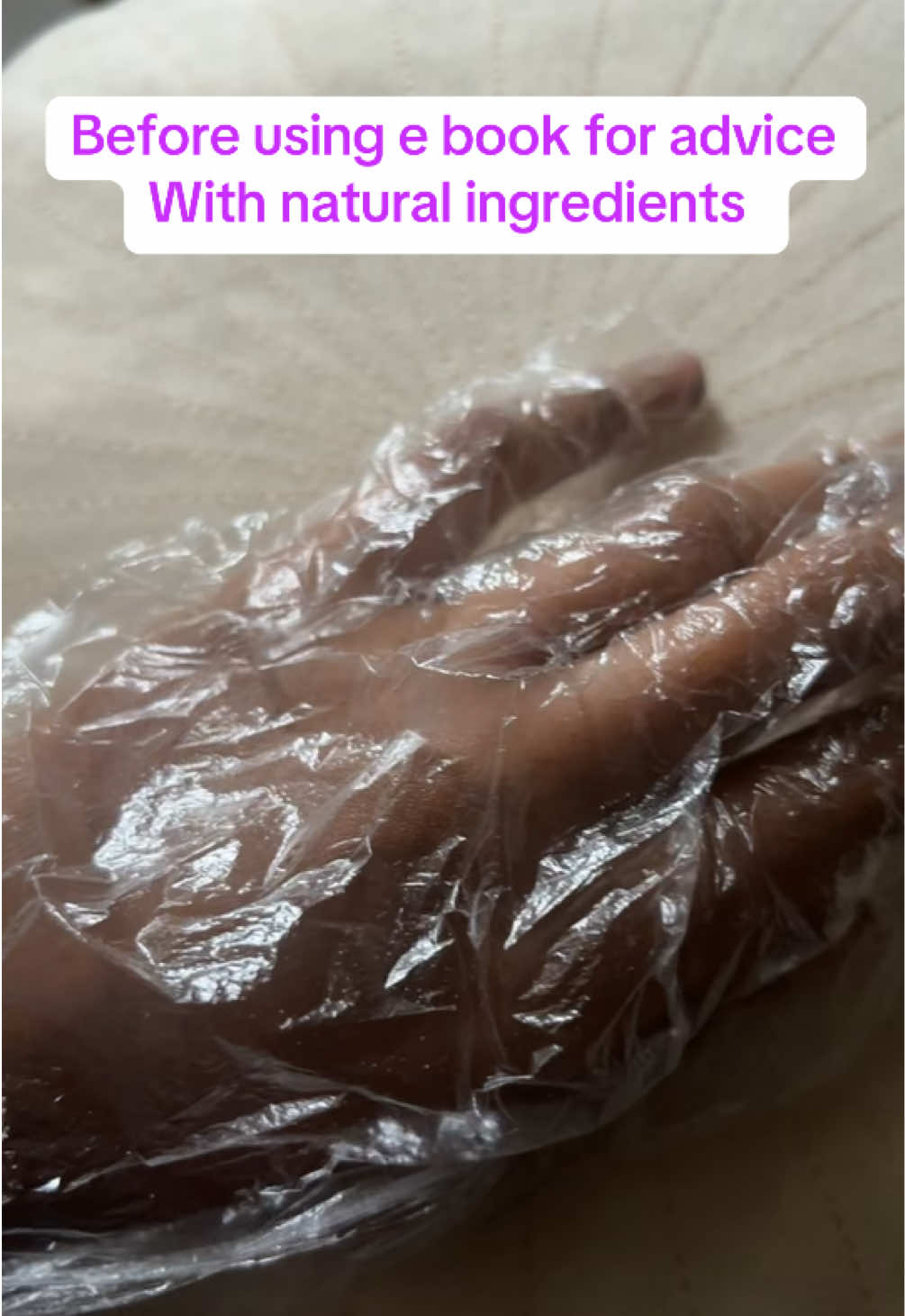 Within 1 week my skin lightened brightened !! These natural ingredients you can find in your house paired with gloves is amazing !!! #skincareroutine #hyperpigmentation #africa #blackskin #knuckles 