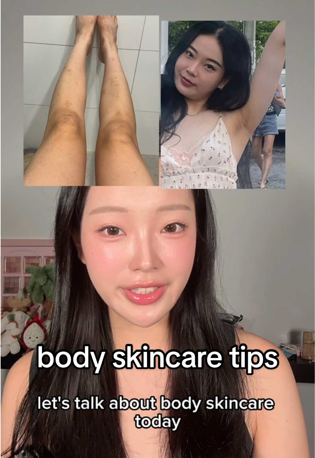 How I got rid of my scars and body hyperpigmentation!! #bodyskincare #hyperpigmentation #underarm #brightening #darkknees 