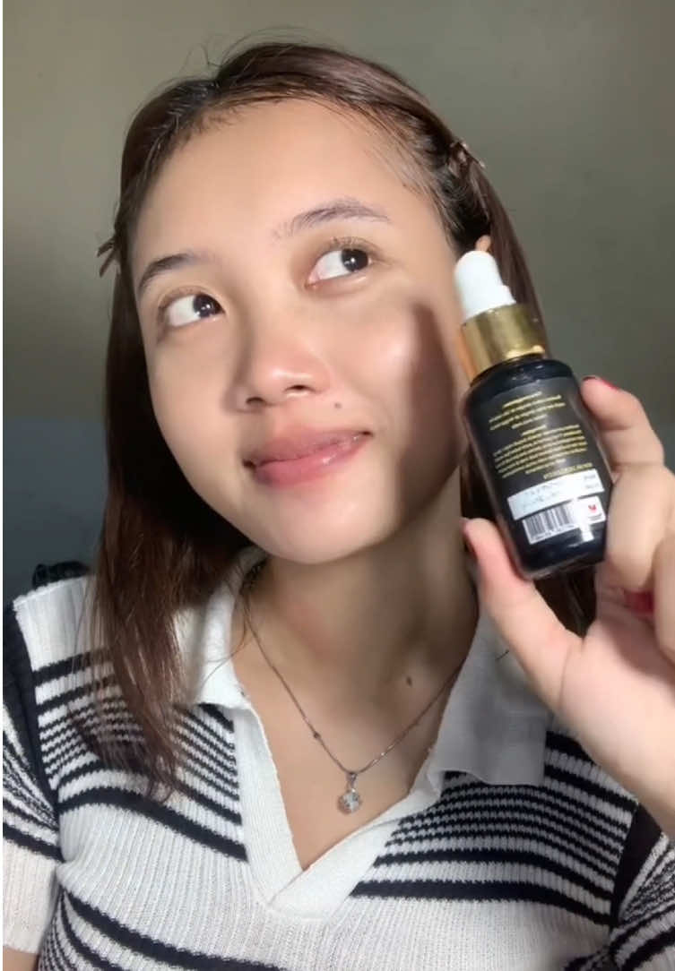 Jerawat jangan di diemin aja ya nnti malah ngamukk😬 #PutriJawaHariIni   #EscanorFacialWash   #SkincareVeganEscanor   #GentleCleanserEscanor   #EscanorVideoChallenge