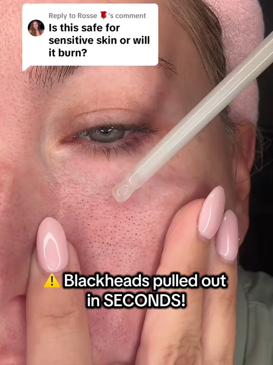 Replying to @ Rosse 🌹 the white rice serum should be used on more delicate areas such as your face & neck. The black rice serum is perfect for more rough and bumpy areas! Both are perfect for sensitive #fyp