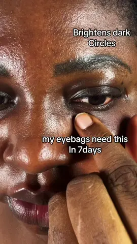 Eye bags in 7 days!? 🔥 @KSECRET GLOBAL  #KSECRETGlowChallenge #KSECRET  #Seoul1988 #darkspots 