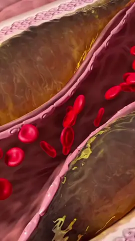 7 Best foods for naturally lower blood pressure 🫀#naturalhealth #foryoupage #foodtiktok #bestfood 