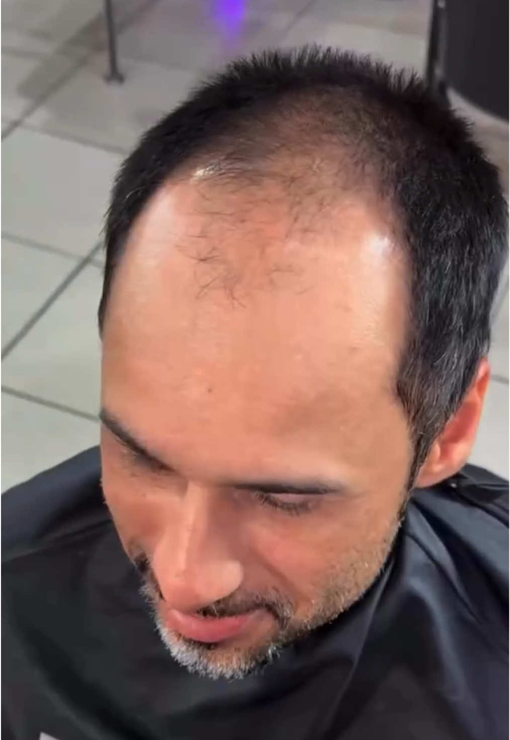 From “is it time to shave it all off?” 🧢 To “yo… you grew that overnight??” 👀🔥 This is the balding-to-full-head transformation you didn’t know was possible no surgery, no dye, no cap (literally). He walked in with a scalp showing, walked out with a crown on 👑 How? Let us break it down for you real quick: 👇🏽 STEP-BY-STEP: THE COMEBACK KIT 👇🏽 💦 Step 1: Prep Your Canvas ✅ Make sure your scalp is CLEAN + DRY (no oil, no sweat) 🌀 Spray 6–8 spritzes of our Fiber Hold Spray to create a strong base ⏳ Let it dry completely before moving on — patience = performance ✨ Step 2: Apply the Real Hair Fibers 🎯 Use the applicator or shake directly to apply Hair Illusion fibers over thinning or bald areas 👀 Watch it blend instantly for a full, natural look — no harsh lines, no chalky texture 💧 Step 3: LOCK IT IN 🛡️ Spray 6–8 spritzes of our Water-Resistant Holding Spray 🌬️ Blow dry on LOW for 1–5 minutes to activate the bond — don’t skip this step‼️ 🔒 This is what makes it gym-proof, sweat-proof, and hat-proof 😎 Step 4: Layer Up (Optional but 🔥) Want MAXIMUM hold? Repeat Steps 1–3 for a second layer. This gives extra thickness + lock-down durability 📸 The end result? ✔️ Natural texture ✔️ No mess ✔️ No streaks ✔️ Just pure confidence that lasts ALL DAY 💯 #hairloss #hairfibers #thinninghair #hairline #balding          