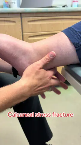 Calcaneal squeeze test for Calcaneal stress fracture/reaction #tiktokdoctor #sportsmedicine #heelpain #medstudent #premed 