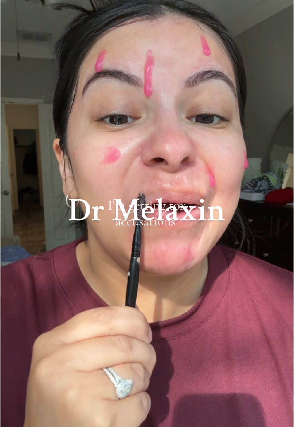 Love the compliment though it’s just not in the budget yet 😉 #drmelaxin #microneedling #drmelaxinpeelshot #antiagingskincare #glowingskincare 