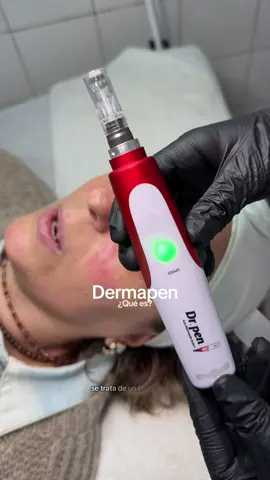 Hablemos del dermapen✨ #dermapen #microneedling #skintok #paratii #tratamientofacial 