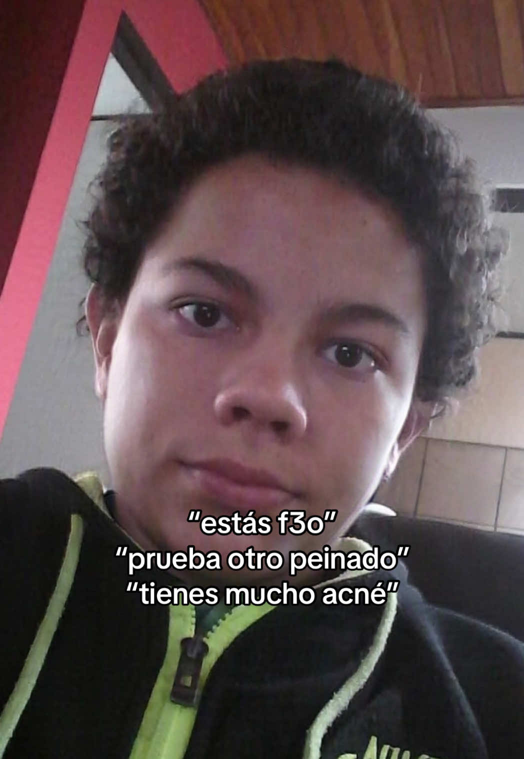 mi combate más largo ha sido contra el acné #javigbrz #GlowUp #fypシ #acne 