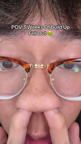 some of yall need this more than me #skincare #koreanskincare #skin #acne #glassskin 