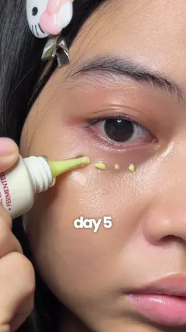 bye bye eyebags, hello fresh eyes ⋆. 𐙚 ˚ 𓍼 work with me ˎˊ˗ 𖦹 mitchliyah9@gmail.com ⋆˚ 𝜗𝜚˚⋆ ⋮ ⌗ ┆ @KSECRET GLOBAL #KSECRETGlowChallenge #KSECRET #Seoul1988 #DarkSpots #eyebags  