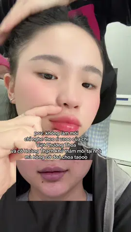tao ko nói là tên sản phẩm là Yuvias có trong dỏ hàng đâu :)) #lavthie @🐣bé bi béo 