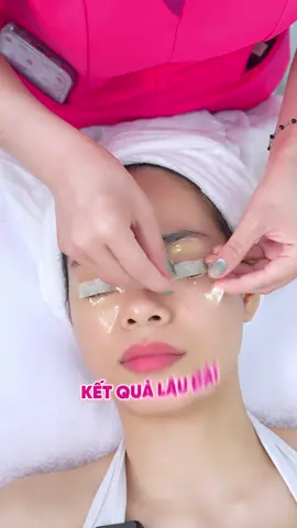 Đừng để mắt già trước tuổi! Trẻ hóa cấp tốc X3 Collagen chỉ 88K + tặng SPA 0Đ, hời cực luôn 😍 Đăng ký sớm giữ chỗ nha.