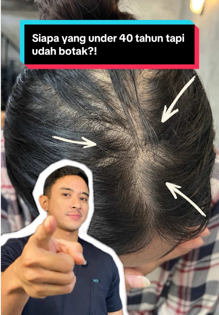 Rambut rontok parah padahal masih muda ternyata bukan cuma faktor keturunan. Coba Kopexil 1.5% yang bisa bantu numbuhin rambut dalam 4 minggu ✨ Apalagi aman buat ibu menyusui, dan bisa jadi solusi buat kamu yang udah putus asa sama kebotakan dini. Cek videonya sampai habis ya! #erhair #hairserum #drdanar #haircare