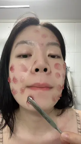 #kbeauty #fypシ #Skincare #skinbarrier #trending @Arencia 