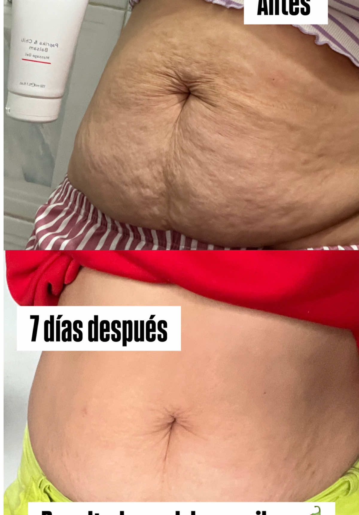 Hace 7 días jamás me hubiese atrevido a mostrar mi barriguita🥹😅 pero no puedo dejar de recomendar este producto que siento que amaré toda la vida 🤩🤩🤩 si tú también lo quieres escríbeme tengo stock disponible 📲 hacemos envíos nacionales 📦🚚 #geldepaprikafarmasi #farmasi #flacidez #resultadosreales 