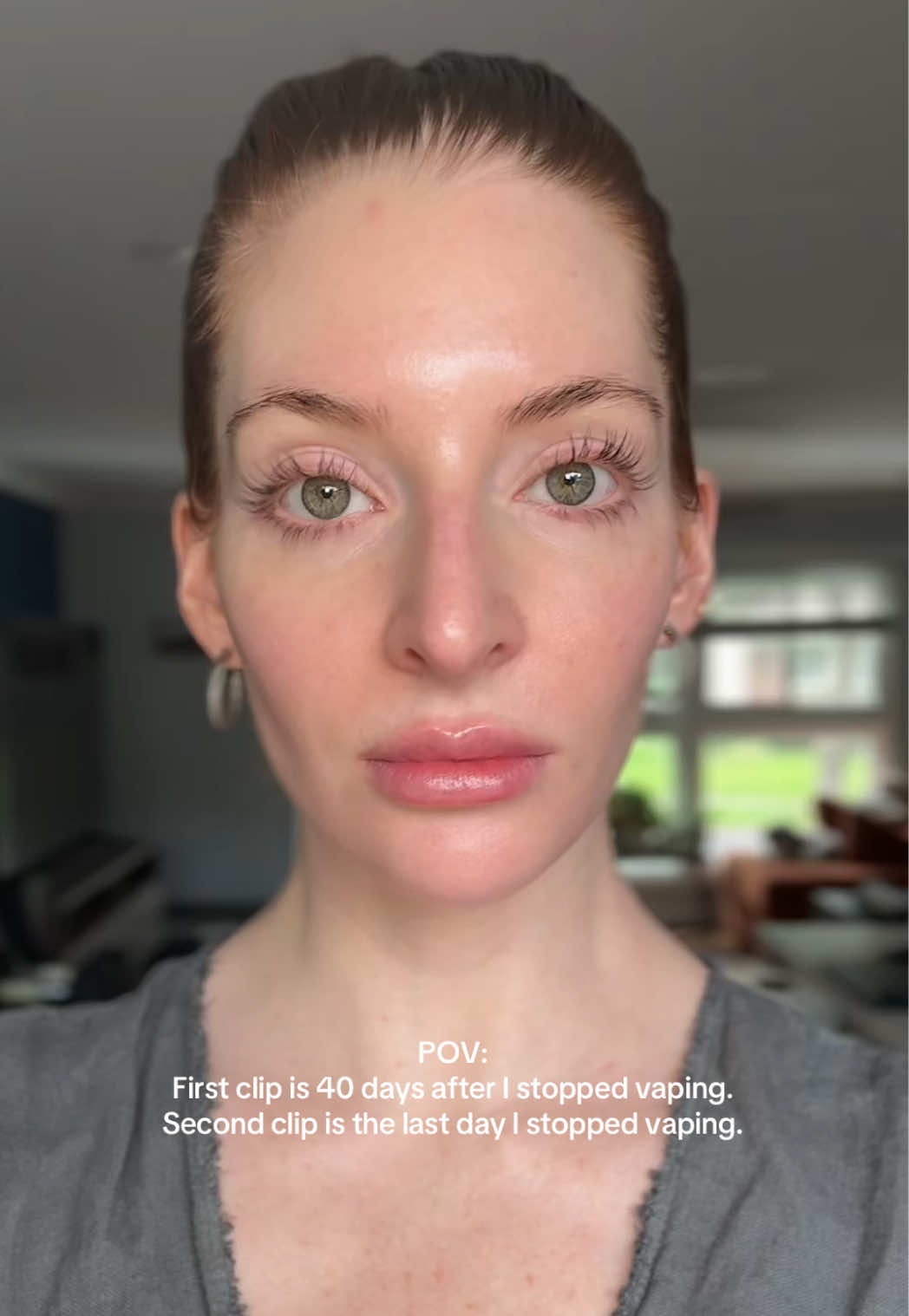 This video went viral on my IG thought I’d share it here. #vaping #quitvaping #fy #skinhealth #smoking  How to quit vaping