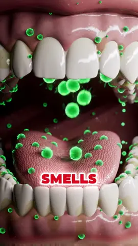 Formula to eliminate bad breath caused by stomach #badbreath #breath #stomach #usa_tiktok 