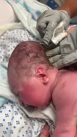 Day 1 and already built like Megamind 🧠👶 #newborn #babiesoftiktok #MomsofTikTok #conehead #parents 