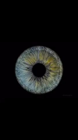 👁️✨ Did you know your iris might tell more than just your eye color? 👉 Iridology is an alternative practice that studies the patterns, colors, and structures of the iris. 🧩 Practitioners believe these details could reflect your overall health and even specific organ conditions. ⚠️ But here’s the catch: while fascinating, iridology is not scientifically proven. Most doctors see it as more of a wellness concept rather than a medical tool. 💡 Still, it reminds us how amazing and unique our eyes really are — like a health fingerprint right in front of us! 👁️ Would you trust your eyes to tell your health story? #eye #tiktok #medicine #medical #ophthalmology 