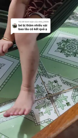 Trả lời @nhlo_2008 kem hỗ trợ thẹo lõm thẹo lồi thâm lâu năm thâm do bong #kemtritham #kemtriseo 