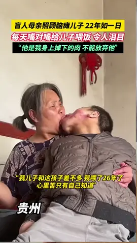 盲人母亲照顾脑瘫儿子22年如一日，每天嘴对嘴给儿子喂饭令人泪目。“他是我身上掉下的肉，不能放弃。”——母亲 #爱 #母爱 #人间真情 #坚强 #感动瞬间 
