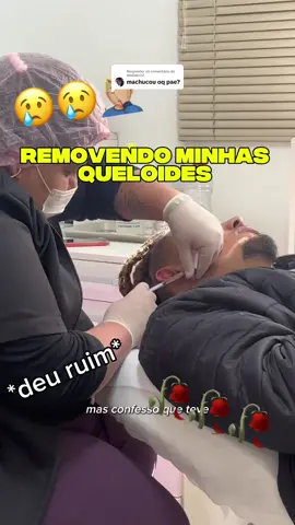 Respondendo a @MAGNUZZ tirando minha queloide gigantesca da orelha e recuperando a auto estima que ela tirou por meses de mim, querem ver o resultado em cicatrização? #locsgang🌴 #queloides #historia #brinco #Vlog 