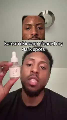 #koreanskincare #darkspots #skincare #hyperpigmentation #tiktokshop 