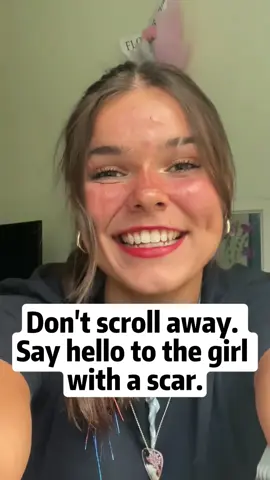 #4u#singlewoman#lonelywoman#fyp#freewomen