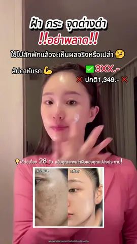 🌼กษัตริย์ของประสิทธิภาพต้นทุน! ชุดครีม 5x + 3x ความชื้นเบาข้อบกพร่อง#papafeel#papafeelth#papafeelเช้าcเย็นa#เช้าcเย็นa#papafeel3xretinol#papafeel5xceramide