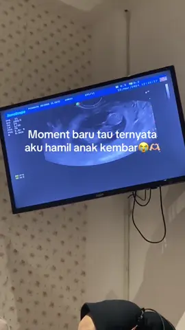 Usg di umur kehamilan 3bulan, shock, nangis, terharu, pokoknya BAHAGIA BANGET baru dikabarin kalau kembar. Masyaallah allah maha baik, hamil pertama kuuu. Sempet kosong 2bulan, tapi alhamdulillah pas isi langsung dikasih kembar🥹😭🫶🏻 Kita semua ga nyangka karna ga kepikiran sama sekali bakalan kembar, aaaaa makasih ya anak2 mama sudah pilih mama dan papa jadi orangtua kalian🥹🥰🫶🏻  Buat yang lagi berjuang garis dua dan kepingin kembar juga, aku doain yaa semoga nular kebahagiaan ini ke kalian🥹🫶🏻  #hamilmuda #hamilkembar #masyaallahtabarakkallah #anugerahterindah #babytwins                     