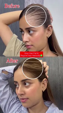 #hairgrowth #natural #Tips #foryoupage❤️❤️ #fypage 