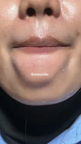 #yogurtpeeloffmask #kulitcerah #fyppoppppppppppppppppppppppp 