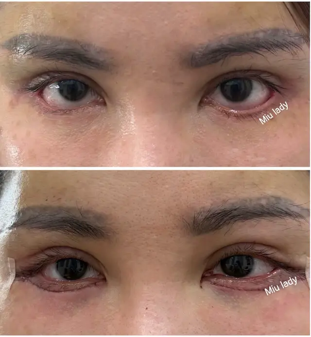 Làm thế nào để biến 1 đôi mắt lỗi trở về 1 đôi mắt bình thường . Nhìn thấy đơn giản mà ko hề đơn giản . ( Video full bên tik tok ) #sửalậtmíduớidrlady #sửamí #kỹthuậtsửalậtmíđộcquyềnvũhuế #sửalậtmísàigòn #sửalậtmíhànội 