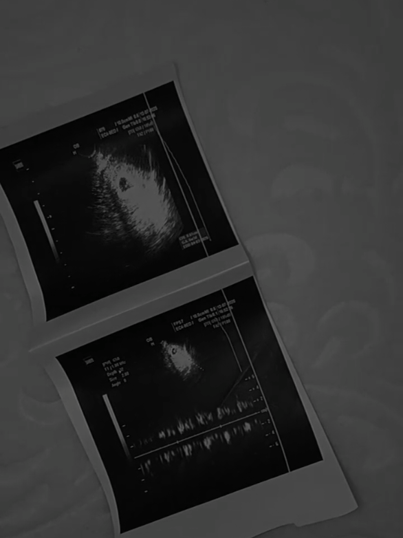 مازال قلبي مفجوعأ برحيـلك  وسيبقـى شيء مستحيـل نسيانه  😓💔 #فقدت #جنيني #اصعب_شعور #الرحيل #💔 