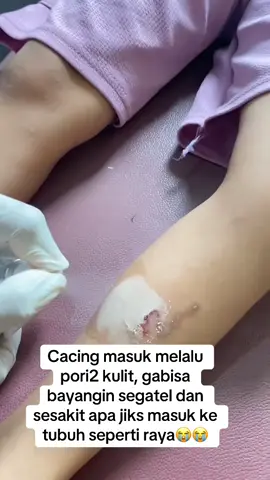 Cacing bahkan sampai ke otak raya😭 #rayasukabumi #fyp #viralvideo #fypage 