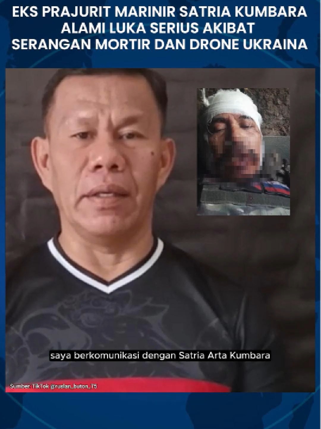 Eks Prajurit Marinir Satria Kumbara Arta Alami Luka Serius Akibat Serangan Mortir dan Drone Ukraina WARTABANJAR.COM – Mantan prajurit Marinir TNI AL, Satria Arta Kumbara, dilaporkan mengalami luka serius saat terlibat dalam pertempuran di Ukraina. Ia terkena serangan mortir dan drone kamikaze ketika berada di garis depan pertempuran. Satria diketahui bergabung dengan kelompok kombatan yang berpihak pada Rusia dalam operasi militer di Ukraina. Saat ini, ia dikabarkan sudah dievakuasi dari lokasi pertempuran. Informasi mengenai kondisi Satria disampaikan oleh mantan anggota TNI AD, Ruslan Buton, melalui sebuah video yang beredar pada Jumat (22/8/2025). #satriaartakumbara #mantanprajurit #marinir #rusia #wartabanjar