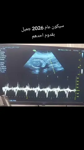 #حامل_ادعولى_اقوم_بالسلامه  الحمد الله وشكر عوض ربي العالمين بعد الصبر وتعب وكسره عوضني بااجمل طفل