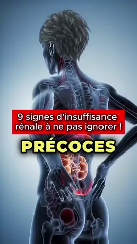 Les pires aliments pour ton cœur ! #santé #santénaturelle #france