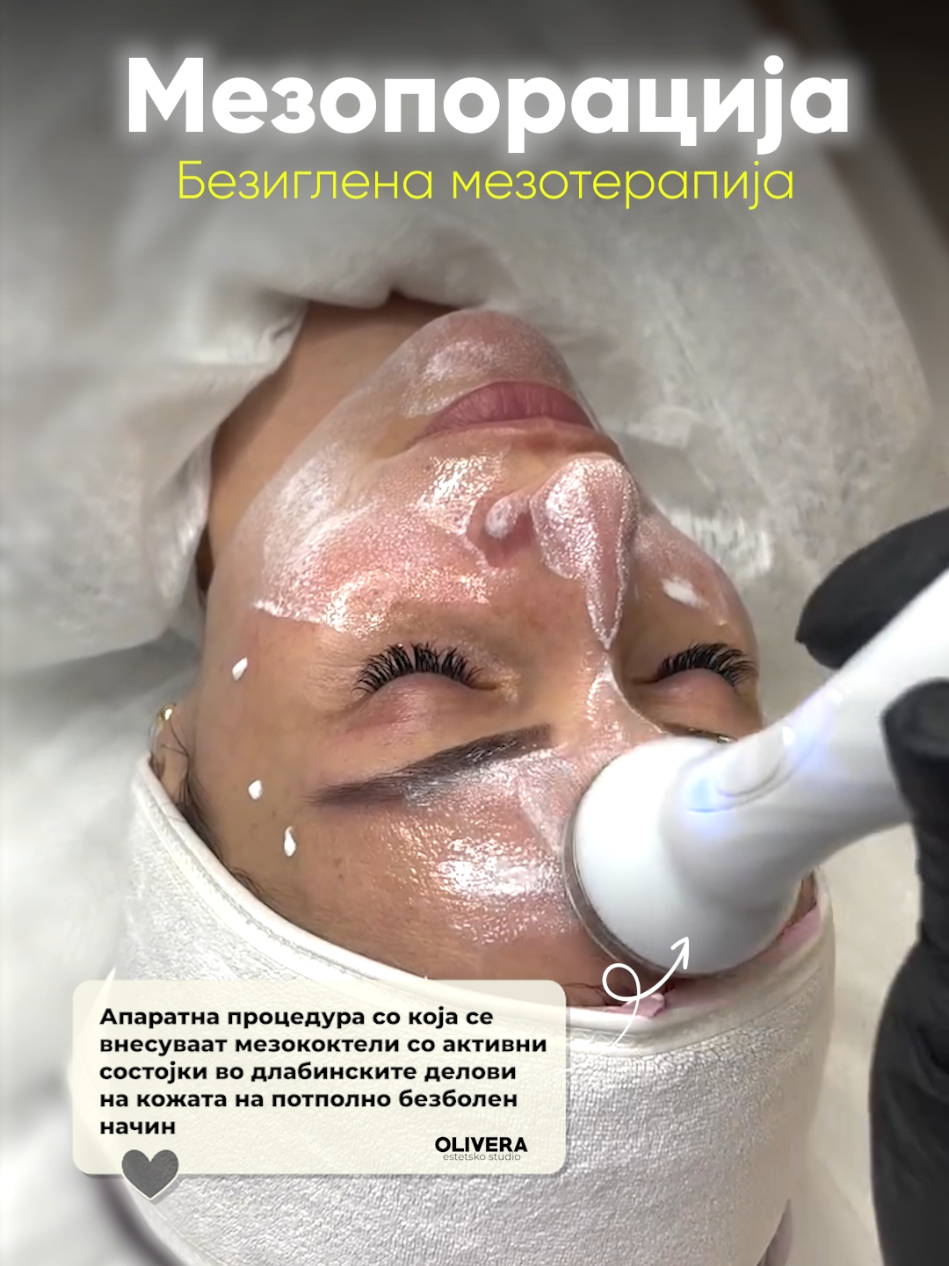 #Мезопорација е процедура на безиглена #мезотерапија со која се внесуваат мезококтели со активни состојки во длабинските делови на кожата на потполно безболен начин.  На овој начин кожата се исхранува, длабински се хидрира и се стимулира синтезата на колаген и еластин, со цел да се зачува нејзината цврстина и еластичност.  Се користи за подмладување на кожата и забавување на процесот на стареење, како и за решавање на голем број дерматолошки состојби.