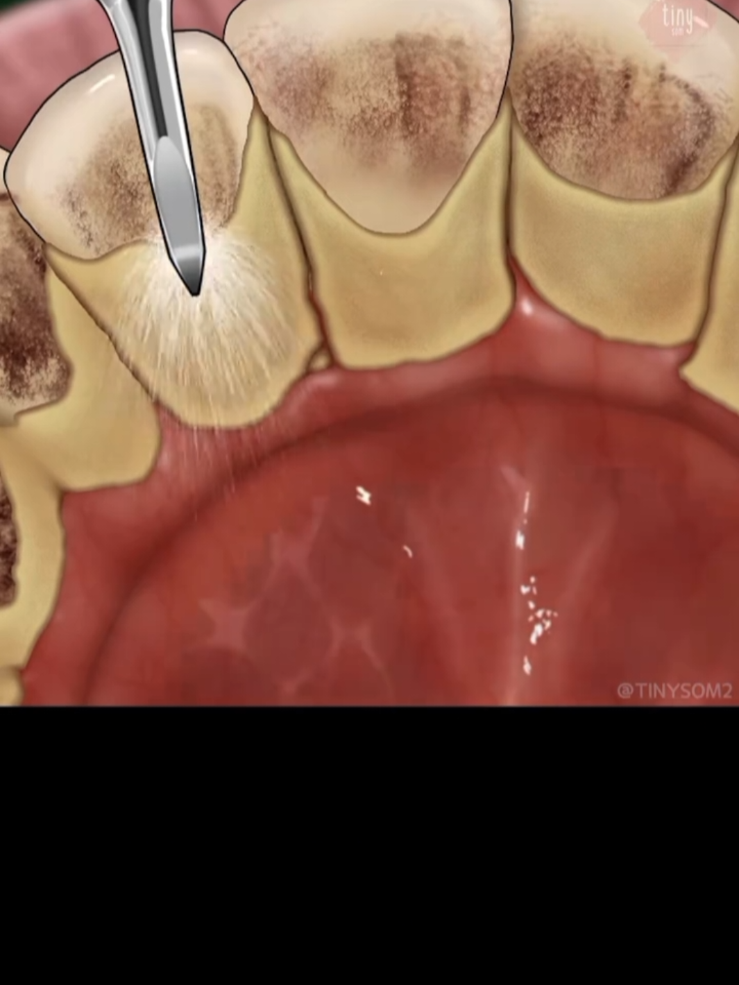 #asmr #satisfyingvideos #asmrsounds #asmrvideo #fyp 