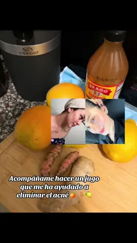 Con discplina fuerza de voluntad y al amor propio por mí logré que esto fuera posible✨🙌🏻 ❤️#paratiiiiiii #viralllllll #paravos #shots #gengibre #curcuma #acne #nomasacne #jugo #amorpropio 
