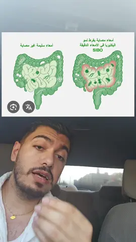 السيبو