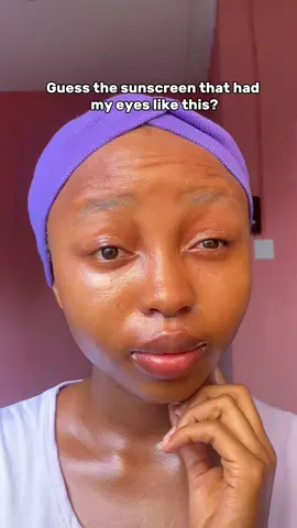 Only real skincare lovers will guess this 👀🥲  Which sunscreen did this to me? 👇 . . . . . . #skincare #sunscreen #skincarecommunity #skinviral #skincareproblems   