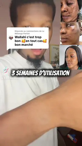 Réponse à @Le Mélange Parfait  💎 Ne cache plus ta peau, soigne-la ! Avec YOXIER, dis adieu aux marques et retrouve confiance ✨ ✔ Efface cicatrices d’acné et anciennes blessures ✔ Atténue les vergetures après grossesse ou perte de poids ✔ Réduit les taches brunes et l’hyperpigmentation ✔ Nourrit et adoucit ta peau jour après jour 🌟 Résultats visibles, peau éclatante et uniforme 💖 📦 Disponible maintenant au Mali – Livraison express partout  #YOXIER #AntiCicatrices #AntiVergetures #BeautéMali #malitiktok🇲🇱   