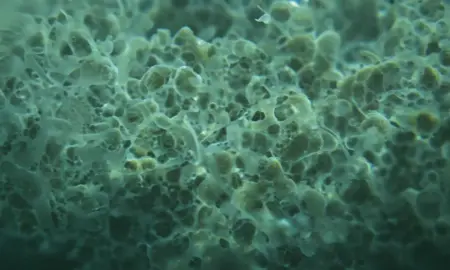 #microscope #tiny #germs #bacteria #virus 