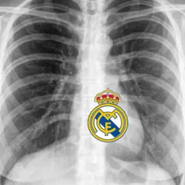 i love el real#realmadridcf #fyp #madridista #foryou #football 