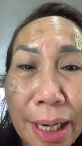 Peel da sau 4 ngày