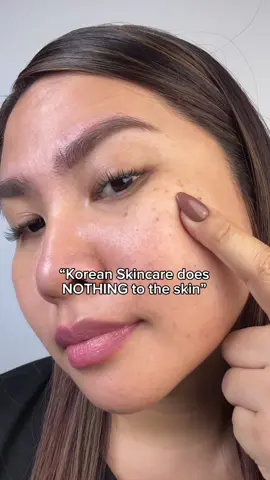 “Korean Skincare does NOTHING to the skin”😱 @Axis-Y Philippines #axisyPhilippines #axisglowserum #glowserum #koreanskincare #kbeauty 