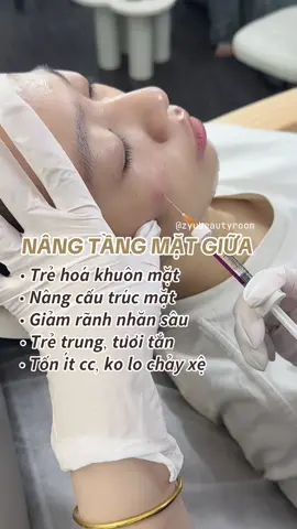 Nâng tầng mặt giữa gì chưa người đẹp!!! Siêu hotttt #filler #bap #botox #mesotherapy 