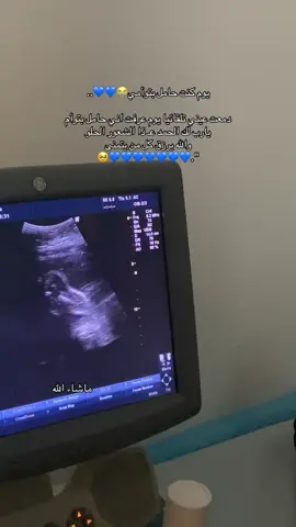 اليوم  بسبب شيمي رجعت حسيت بنفس شعوري وقتها والله يرزق كل محروم يارب🥹💙💙💙.  #قشعريرة #شيمي #حامل #بتوام_عيال  @شيمي 🎶🧡 .. 